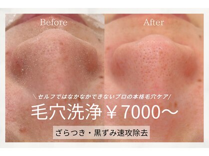 ワックスサロンアトリア(wax salon ATRIA)の写真