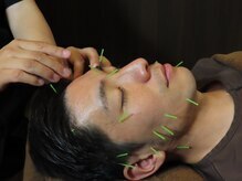 康泰苑鍼灸整体院/落ち着いた空間の美容鍼