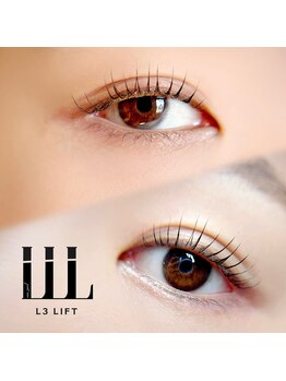 エフ(eFu)/◇施術イメージ◇