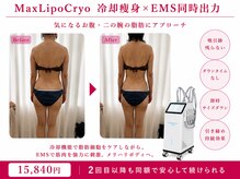 オリエンタルローザ 表参道(Oriental Rosa)/一度で二の腕&お腹を同時にケア