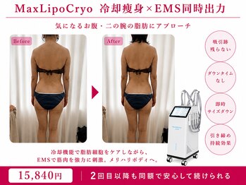オリエンタルローザ 表参道(Oriental Rosa)/一度で二の腕&お腹を同時にケア