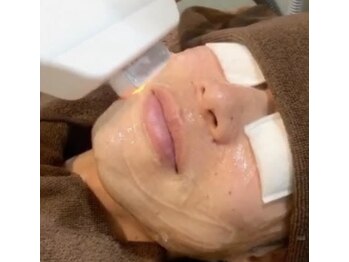 アグライア(Aglaea)/メンズ【髭脱毛】