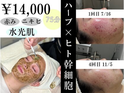 リンフェイス 高松店(LINFACE)の写真