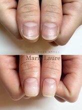 マリーロール 淀屋橋本店(Marie Laure)/自爪育成/深爪矯正/ネイルケア
