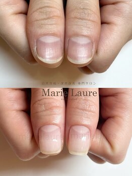 マリーロール 淀屋橋本店(Marie Laure)/自爪育成/深爪矯正/ネイルケア