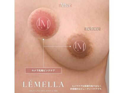 ピュアソル(Puresol)の写真