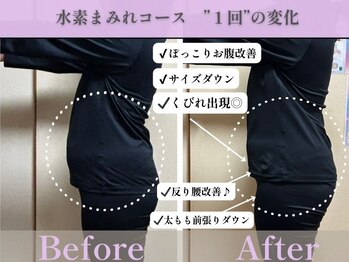 ヨサパーク 天(YOSA PARK)