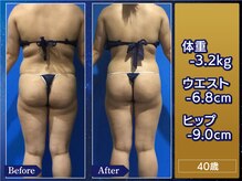 プリオール 高崎花水木店(Prior)/痩身フォトコンテスト