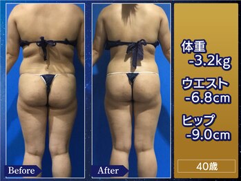 プリオール 高崎花水木店(Prior)/痩身フォトコンテスト