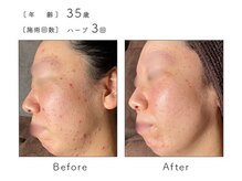 メイクアップスタジオ ウィッシュ(Make up Studio Wish!)