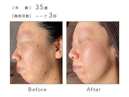 メイクアップスタジオ ウィッシュ(Make up Studio Wish!)の写真