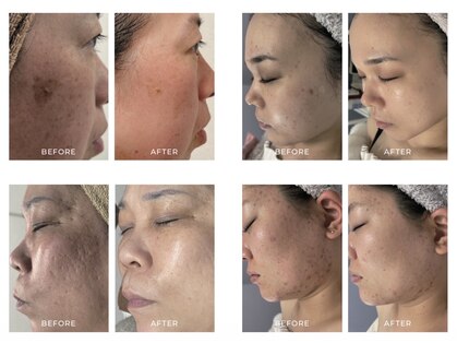 ナチュリー(Naturry)の写真