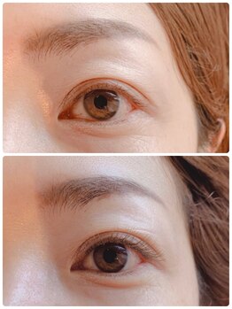 バードアイ(bird eye)/まつえく