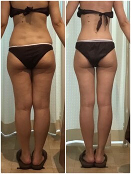 マイアンジェリーク 南店/エステ