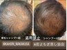 【育毛の促進】男女共に☆本気の育毛を促進◎（髪の毛お悩みの方・予防）