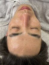 リコリス(Lycoris)/毛穴洗浄