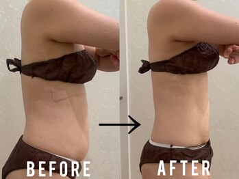 ビュール 銀座(BeauL)/ブライダルエステ