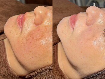 ルーナジェーナ(Luna llena)/池袋　エステ　ルーナジェーナ