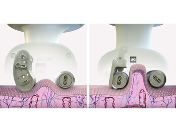 クイーン 大宮/最新エンダモロジインフィニティ