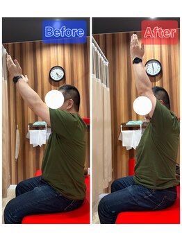 みらい整体院 山形南院/Before　After