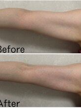 カシェボーテ(CACHE BEAUTE)/