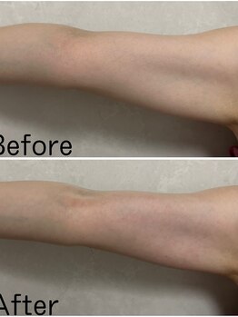 カシェボーテ(CACHE BEAUTE)/