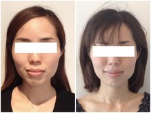 美容整体 ウェリナ 蟹江院/小顔矯正/骨盤矯正/美脚サロン 