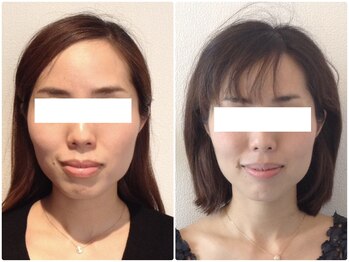 美容整体 ウェリナ 蟹江院/小顔矯正/骨盤矯正/美脚サロン 