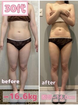 サロン ド フェイス モアナ(Salon de Faith Moana)/キャビテーション痩身【30代】