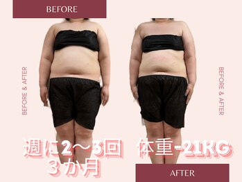 ヨサパーク モア(YOSA PARK Moa)/Before・After