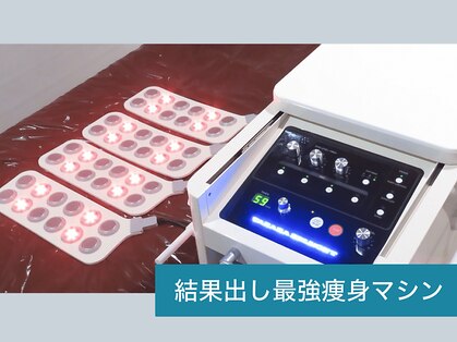 シャンティ(Shanti)の写真