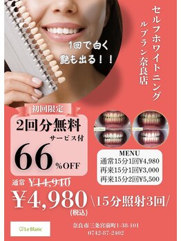 ルブラン 奈良店(Le Blanc)/歯の黄ばみ大丈夫ですか？？