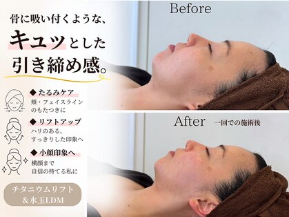 ラヴィニティ 池袋(Lavinity)の写真