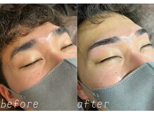 ボス 名古屋店(BOSS)/Before&After5 #メンズ脱毛#眉毛
