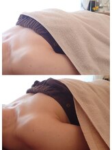 ルフルリール(Refleurir)/デコルテの削げ感お悩みでした…