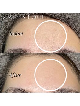 パリスエリー(PARIS ELLY)/メタジェクト☆