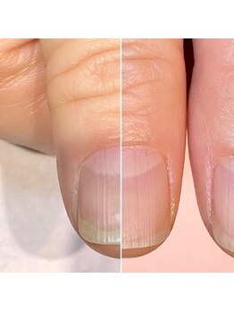 ココデネイル(cocode nail)/悩み:割れやすい(40代前半)