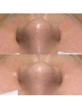 ファウンデーション(FOUNDATION)/ベルベットスキン