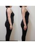 【初回特別価格】3ヶ月で-10kg続出！ダイエットカウンセリング＋鍼施術体験 