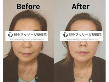 心鍼灸マッサージ整骨院/美容鍼