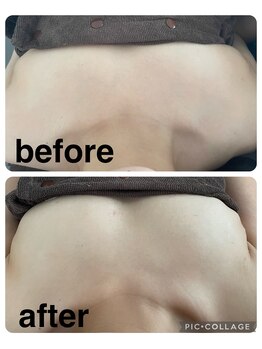 ギンザアール(GINZA R.)/バストアップ♪