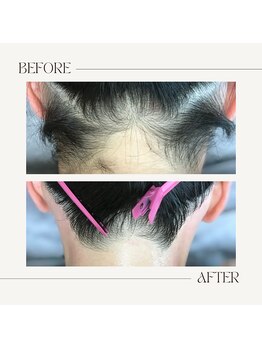 スプランドゥール(Splendeur)/レディース【うなじ】WAX+光