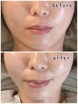 リムー(RE@Muu)/お顔のお悩みに