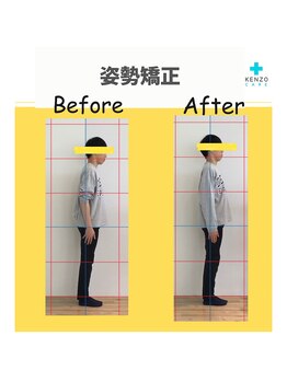 ケンゾー接骨院(KENZO接骨院)/姿勢改善