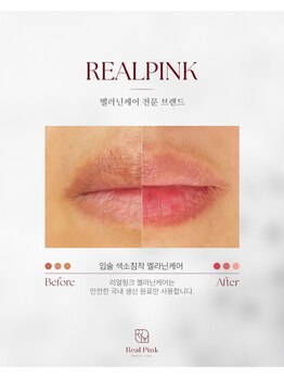 アネラ(ANELA)/Real Pink