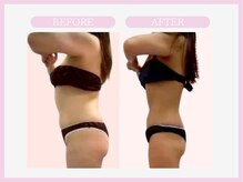 アコガレコガオ 青森店/