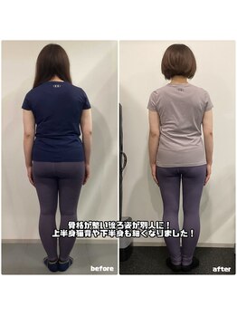 ナナ 札幌店(NANA)/20代お客様のビフォーアフター