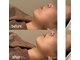 ナビ(NAVI)の写真/最新たるみ機械で本気のたるみ改善！