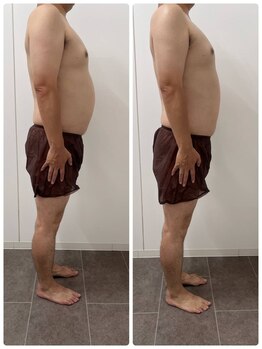 アンドコー(＆co.)の写真/【脂肪燃焼×ボディデザイン】根本から整える本格痩身で、３６０度どこから見ても美しいシルエットへ♪