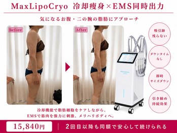 オリエンタルローザ 表参道(Oriental Rosa)/一度で二の腕&お腹を同時にケア